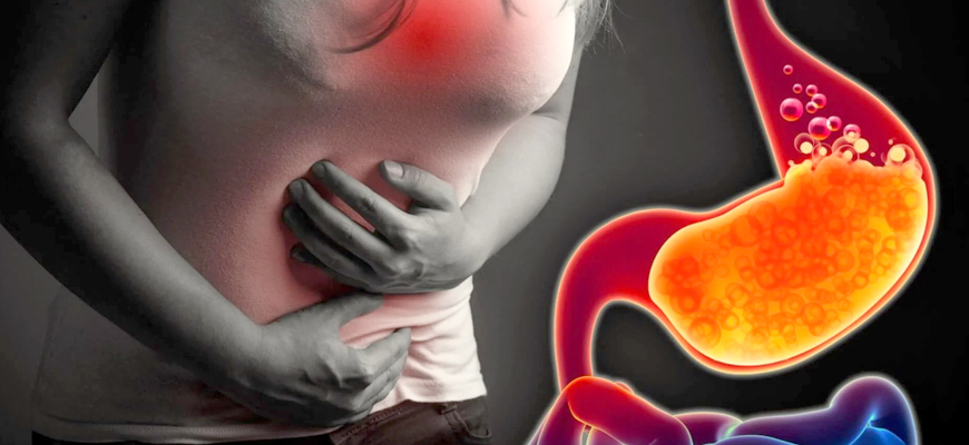 Management of Acidity & Digestive Problems